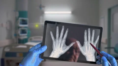 Hand X-Ray Display On Tablet Held By Gloved Hands In Hospital Room Stock Footage 329906253