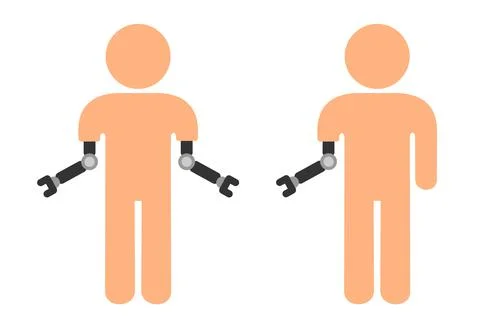 Handicapped, disabled and crippled armless man with prosthesis and prosthetic Stockillustratie