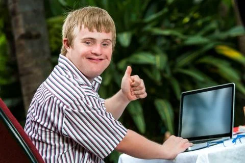 Handicapped student working on laptop. Stock Photos