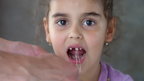 The hands of an adult pull the thread tied to the child's tooth. Successful Stock Footage 119277467