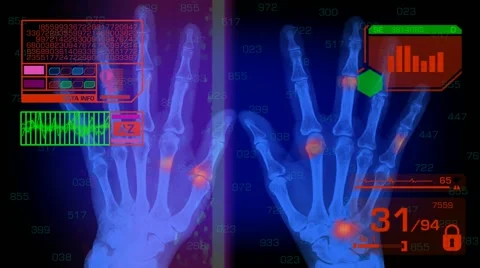 Hands Analysis - Graphics - Red 01 Video stock 56842065