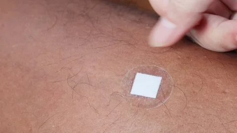 Hands applying a transparent adhesive dressing to a skin wound Stock Footage 347588838