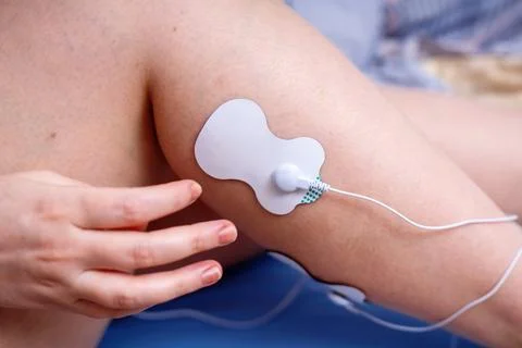 Hands attaching an electrode from an electrical muscle stimulator to a leg,.. Foto stock