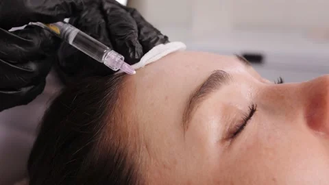 Hands in black gloves make botulinium toxin shots closeup Stock-Footage 197095847