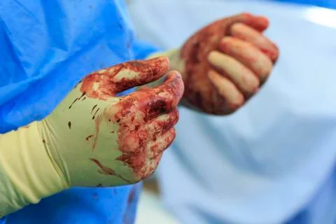 Hands in blood Stockfoto's