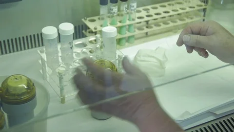 Hands close up of technician during analyzes tuberculosis bacillus by Pakito. Video stock 74832507