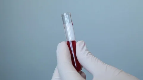 Hands In A Disposable Laboratory Gloves close down A Test Tube With Blood Stock Footage 127539378
