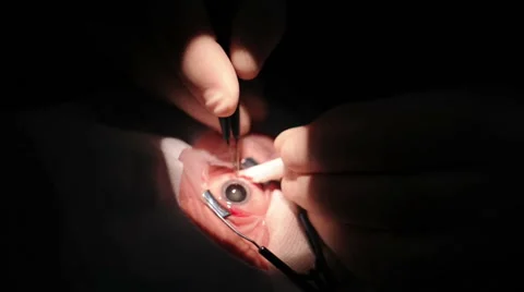 Hands doctor with tools making eye surgery Stock Footage 59564722