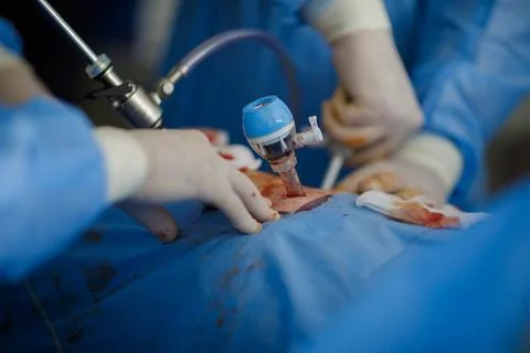 Hands of doctors performing laparoscopy operations Foto stock