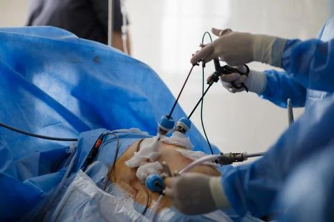 Hands of doctors performing laparoscopy operations Foto stock