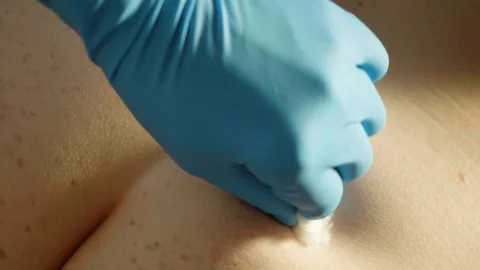 Hands in gloves make injection fast with one try. Close up and up view. White Stock Footage 114131065