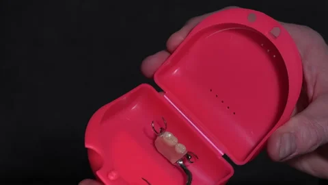 Hands holding red case with dental prosthesis inside, close-up view Stock Footage 338263495