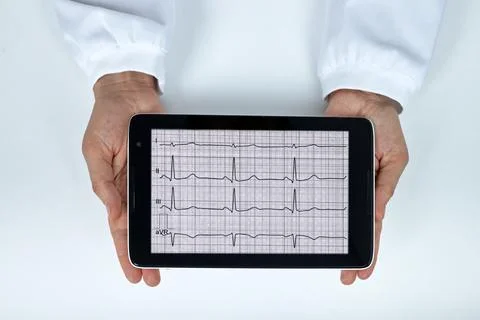 Hands holding a tablet computer displaying an electrocardiogram rhythm chart. Stock Photos