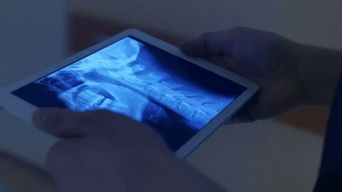 Hands holding a tablet with x-ray Stock Footage 75131882