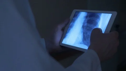 Hands holding a tablet with x-ray Stock Footage 75132425
