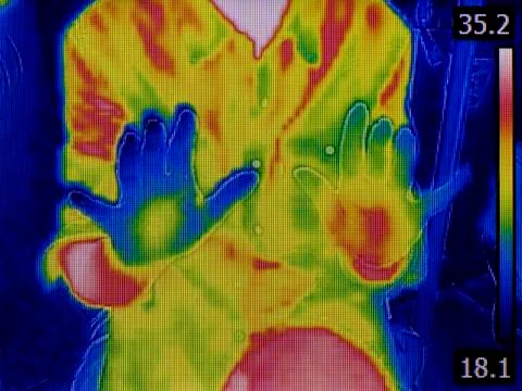 Hands Infrared Stock Photos