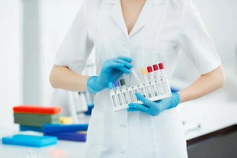 Hands of a lab technician holding a rack of color test tubes with blood samples Foto stock