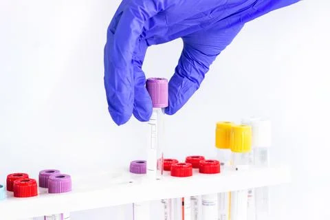 Hands of a laboratory assistant with a blood sample and fortitude with blood  Stock Photos
