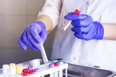 Hands of a laboratory assistant with a blood sample and fortitude with blood  Stock Photos