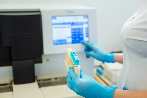 Hands of laboratory assistant loading sample tubes for coagulation test analysis Stock Photos