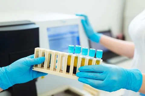 Hands of laboratory assistant loading sample tubes for coagulation test analysis Stock Photos
