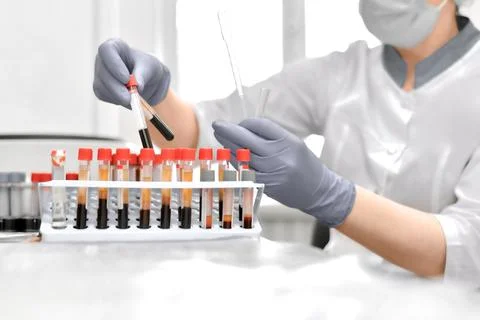 Hands of the laboratory assistant while working with blood tests in test tubes. Stock Photos