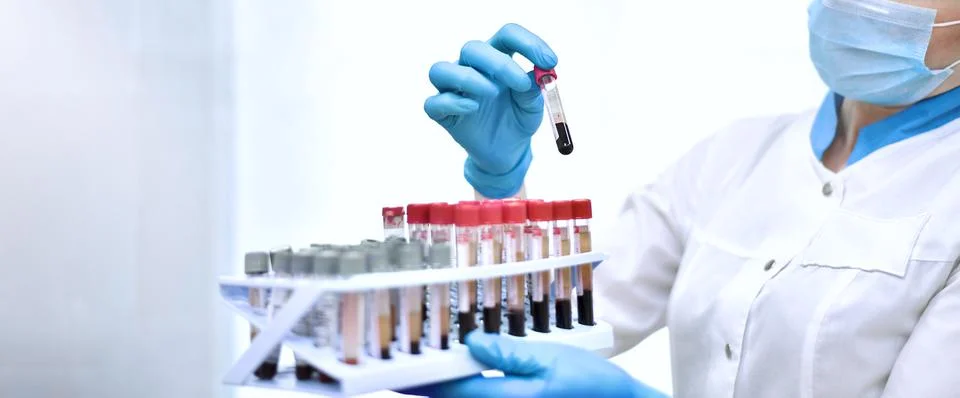Hands of the laboratory assistant while working with blood tests in test tubes. Stock Photos