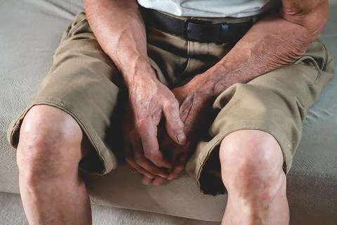 Hands on legs of an elderly man Stock Photos