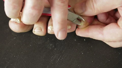 The hands of a man use a tool to remove sore flexible nails from their toes Vidéo 111917721