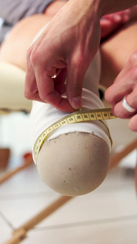 Hands, measuring and leg of amputee person for fitting, prosthetic limb and Stock Footage 332323880