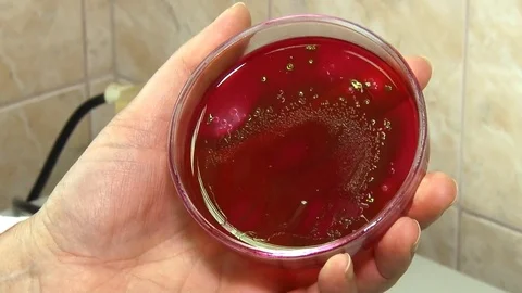 In the hands of a microbiologist a petri dish with microorganisms. Vídeo Stock 127320964