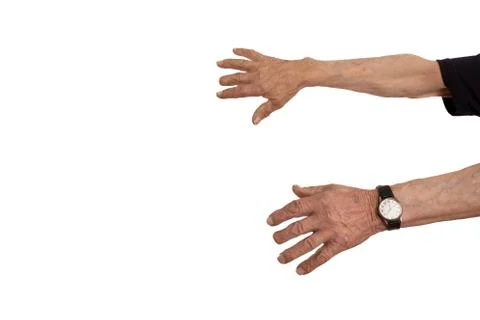 Hands of an old man with a missing middle finger phalanx on the white background Stock Photos