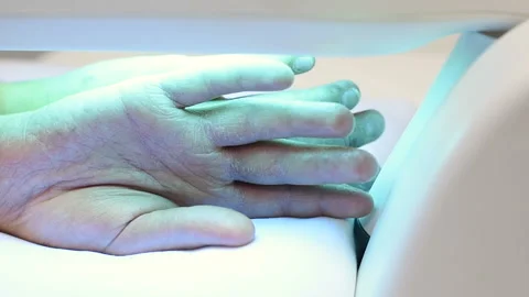 Hands of a patient with psoriasis close-up under an ultraviolet lamp. Stock-Footage 100607134