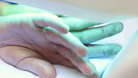Hands of a patient with psoriasis close-up under an ultraviolet lamp. Stock-Footage 101436857