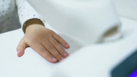 Hands of a patient with psoriasis close-up under an ultraviolet lamp. Video stock 102907749