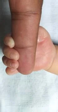Hands Stock Photos