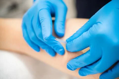 Hands of physiotherapist doing a dry needling Stock Photos