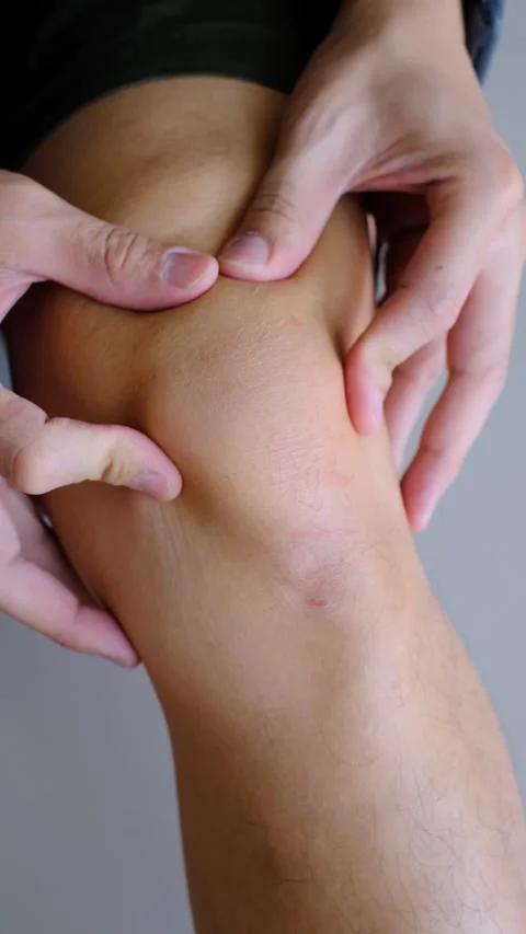 Hands pressing and examining the skin around a knee joint Stock Footage 304310946