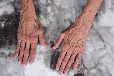 Hands resting on a marble surface in a simple setting Stock Photos