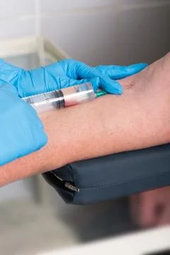 Hands in rubber medical gloves do an injection in a vein Stock Photos