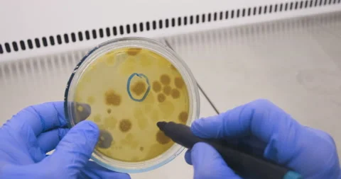Hands of a scientist with colonies of bacteria Stockbeeldmateriaal 172402361