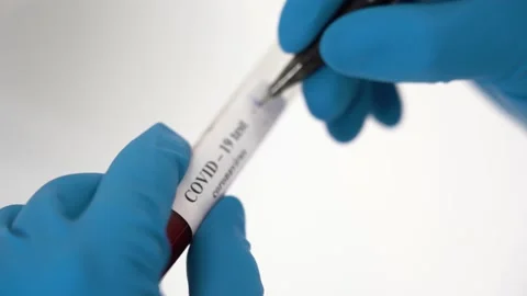 Hands of scientist man, marks test for coronavirus infection, creates vaccine Stock Footage 131478222