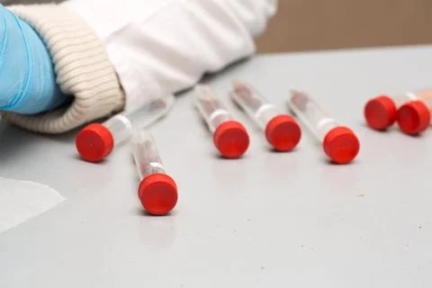 Hands of scientist working with tubes 스톡 사진