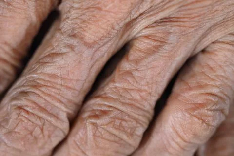 Hands show texture and lines of aging Stock Photos