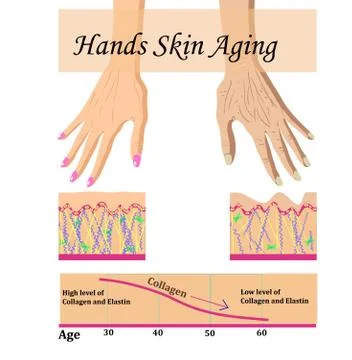 Hands skin aging, vector illustration with a chart Stock Illustration