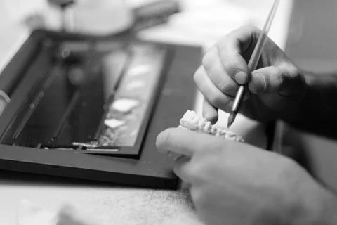 Hands of a specialist in the process of manufacturing a prosthesis in a denta Stock Photos