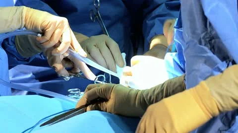 Hands Specialized Team Performing Surgery Close Up Stock Footage 12693605