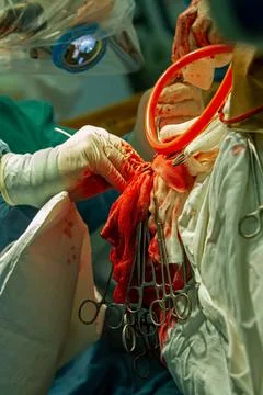 The hands of the surgeon during the operation Stock Photos