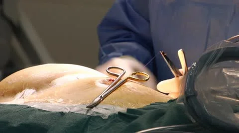 Hands surgeon Video stock 10915095