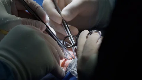 The hands of a surgeon Stock Footage 127702105